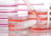 CAR-T cell therapy